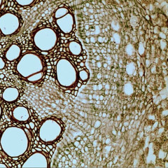 feel my pain (prod. rémdolla)