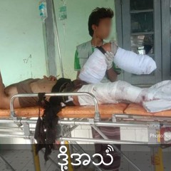 Episode 336:Civilian landmine casualties increasing since Operation 1027 in northern Shan state