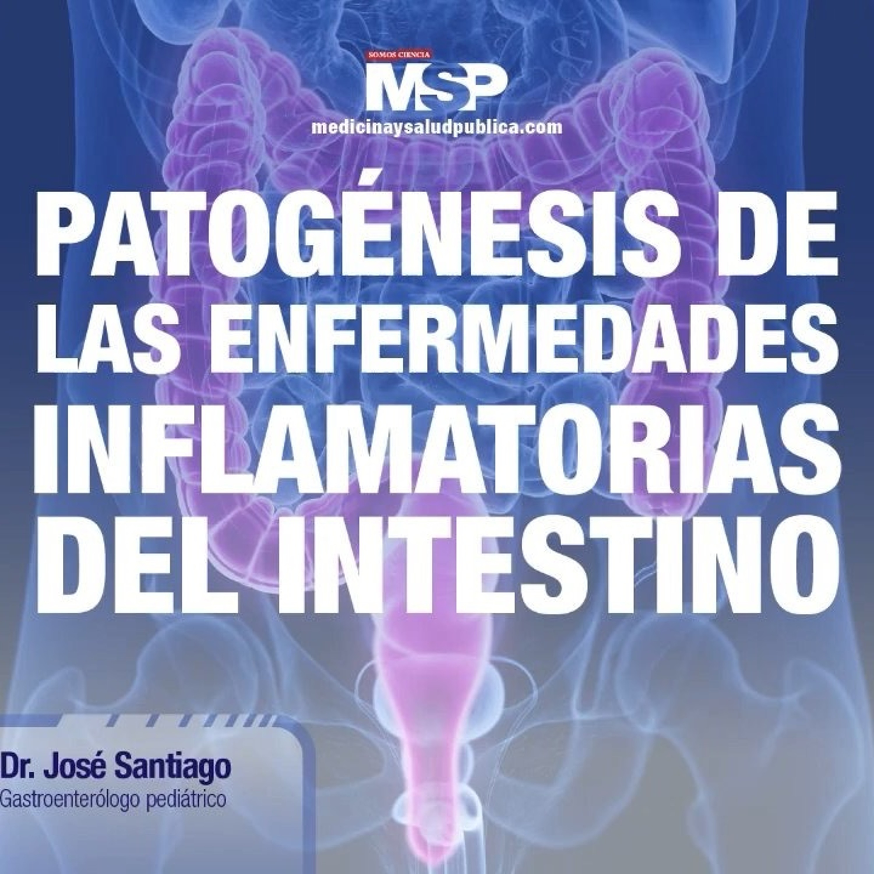 Patogénesis de las enfermedades inflamatorias del intestino