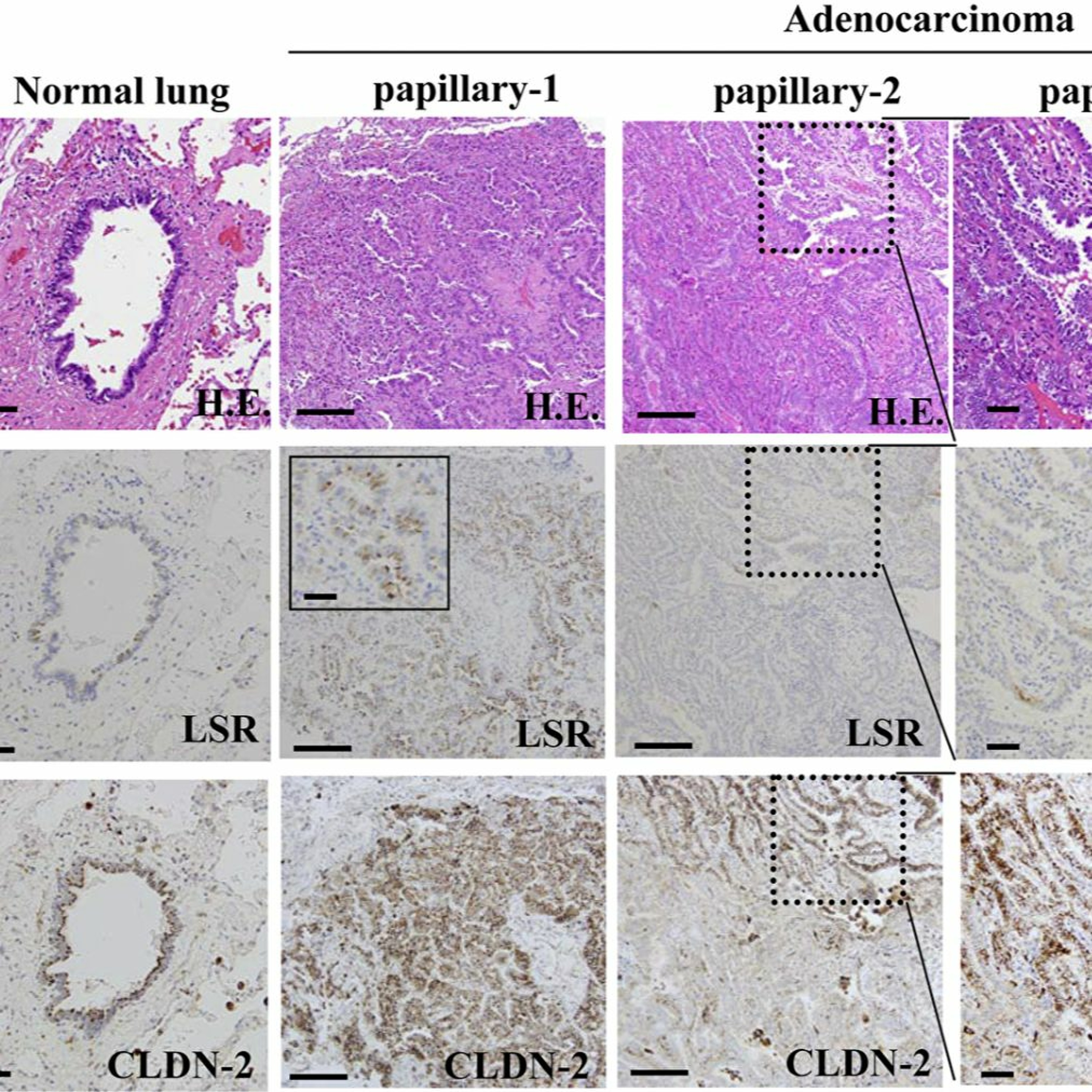 Oncotarget