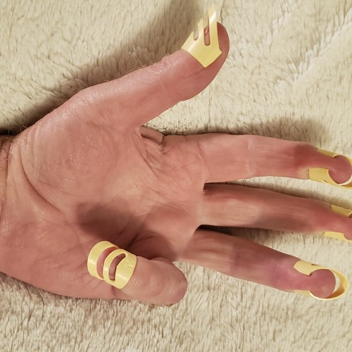 Claw Hand Of Franklinos