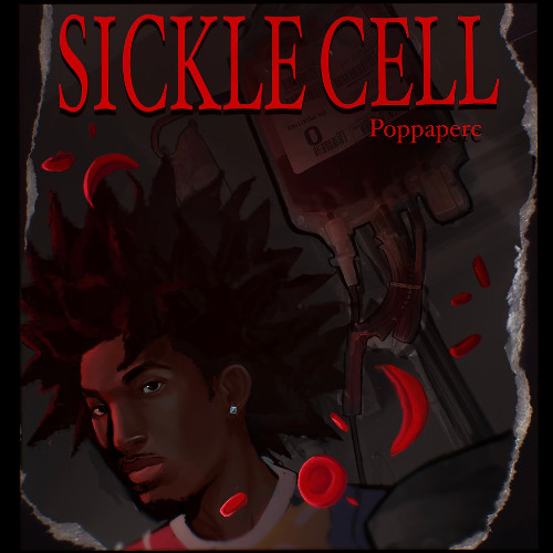 Sickle Cell