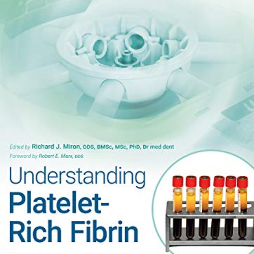 Read PDF 📪 Understanding Platelet-Rich Fibrin by  Richard J. Miron EBOOK EPUB KINDLE