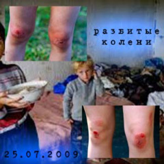 разбитые колени