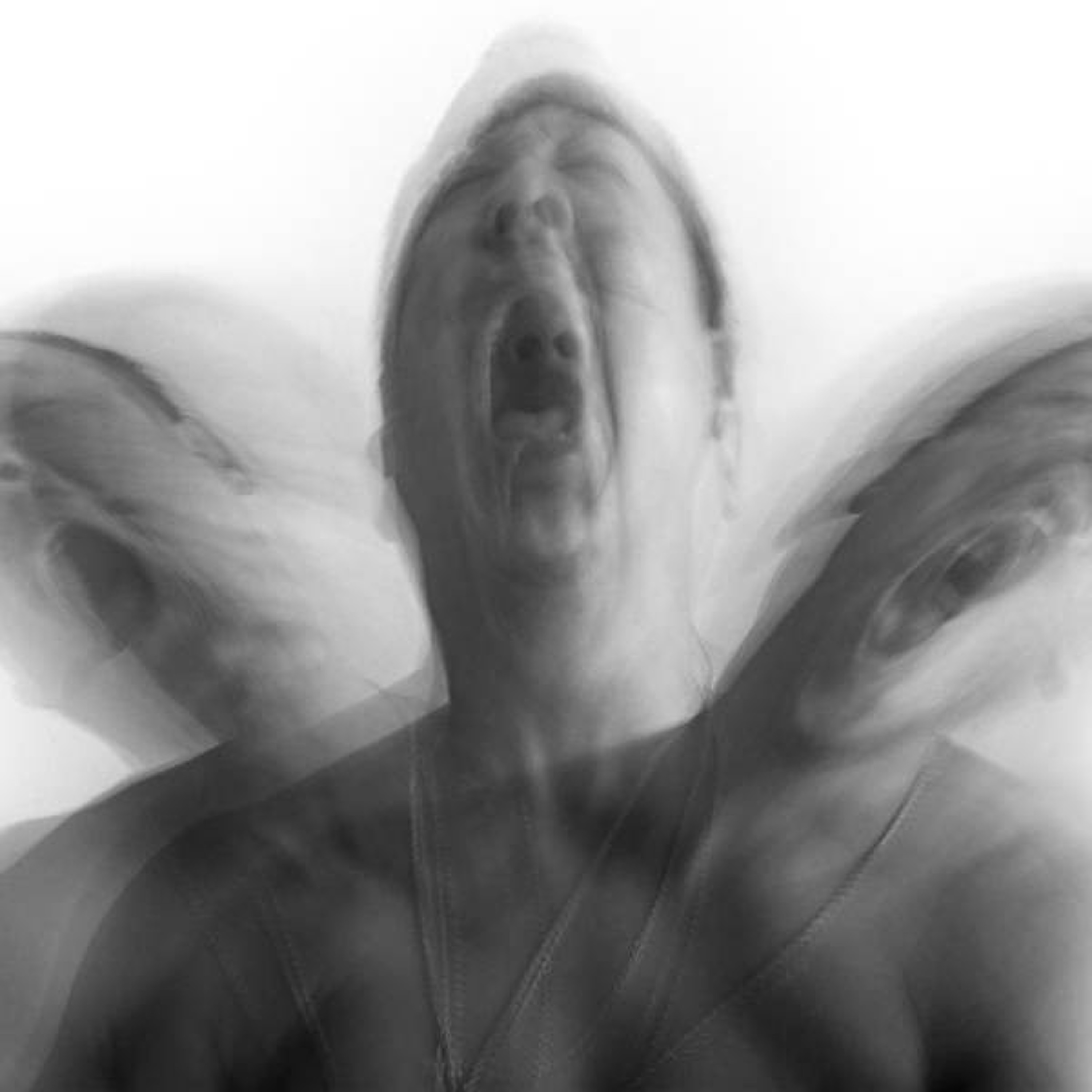 Ranton D.-Fly episode artwork