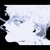 Artwork for Today 2011 Remastered | Slowed down; Daycore