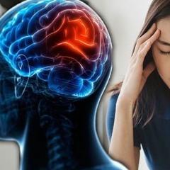 Iota - Migraine Headache