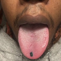 LSD