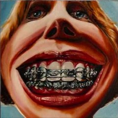 Skream - Metal Mouth (Melophobe Bootleg)