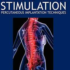 READ EPUB ☑️ Spinal Cord Stimulation: Percutaneous Implantation Techniques by  Paul K