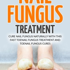 [View] EBOOK 💞 Nail Fungus Treatment: Cure Nail Fungus Naturally With This Fast Toen