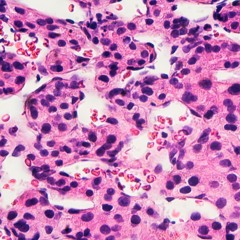 Tumors (MOONBOY Exodus Contest)