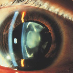 The Symposium - April Snow (Cover)