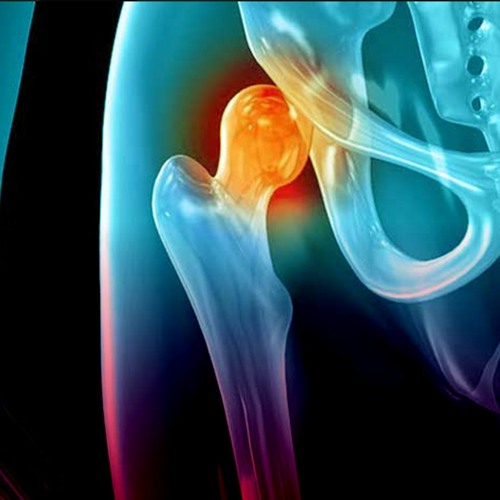 Stream Замість 70 тис грн безкоштовний протез та операція: як у ...