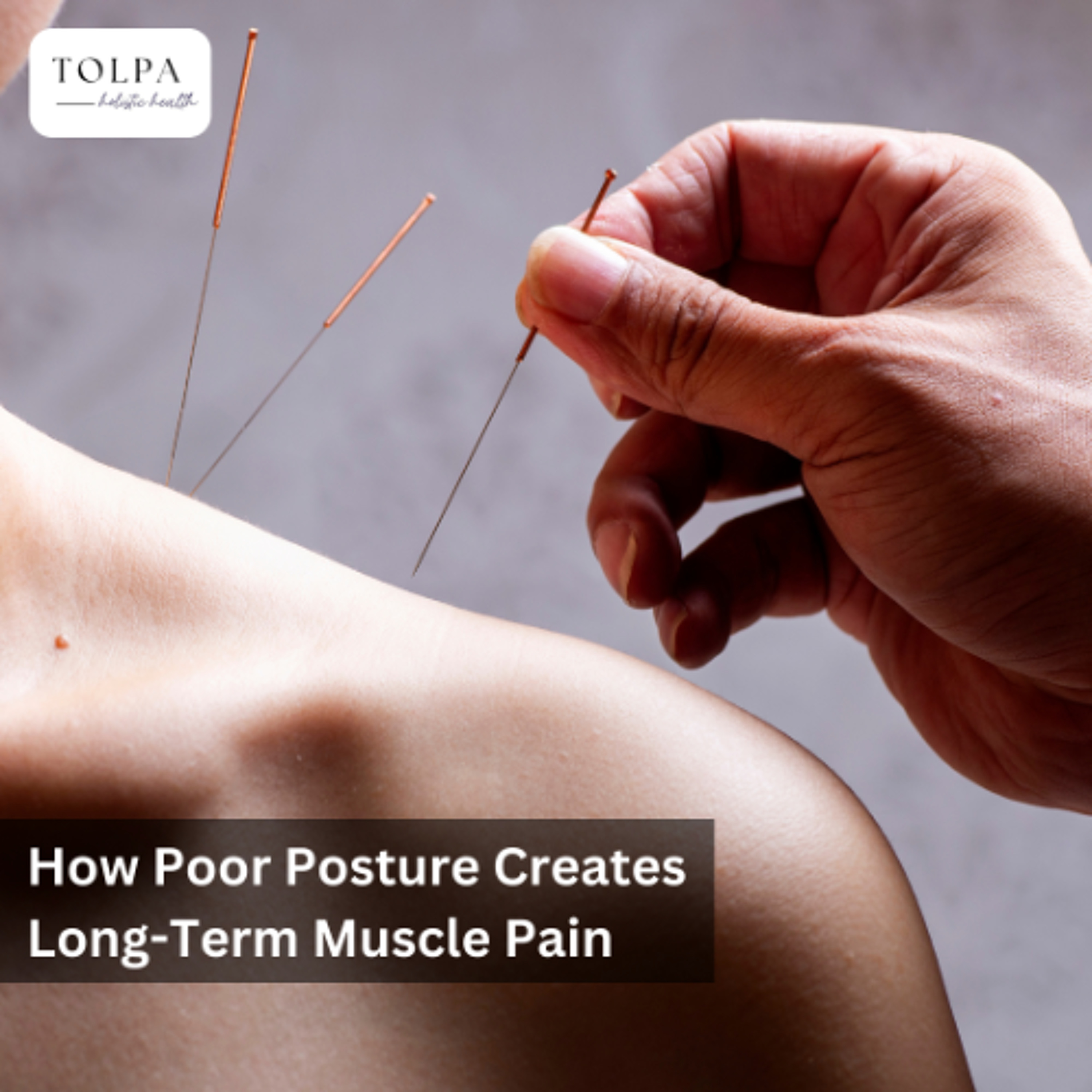 How Poor Posture Creates Long-Term Muscle Pain
