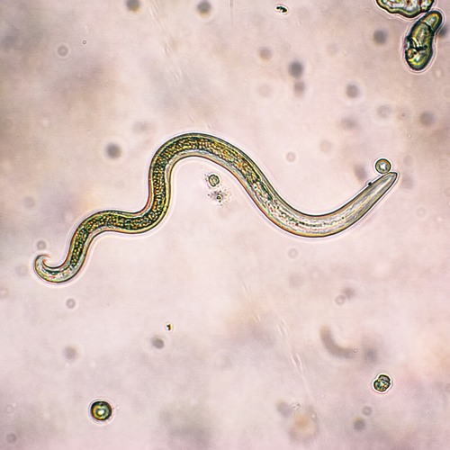 Dr. Lee Merritt: The Connection Between Parasites & Cancer + COVID Shots & 5G