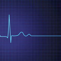 no_pulse_(S1)_154bpm_emin