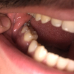 Flesh & Teeth (F&T) - POPPA FUZE (Prod: Astro)