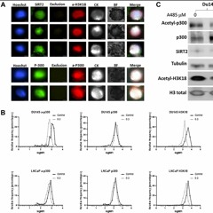 A Multiplex Assay to Assess Activated p300/CBP in Circulating Prostate Tumor Cells