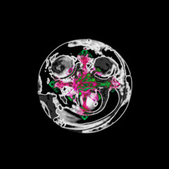 L1L1 1(DEFORMED KINGDOM REMIX)