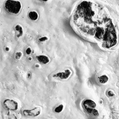 Re:nald - acidiculous