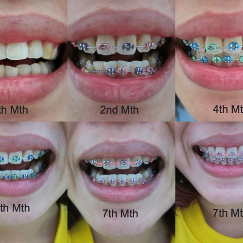 prettifun ft cayo banks - sparky (cyber underground sped up)