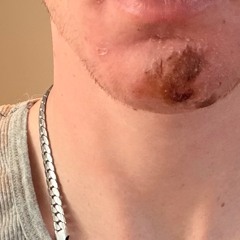 geek bar (P. exhaleruntz)