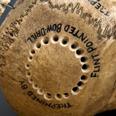 My Tribe - Shtoompah vs. Acidbat