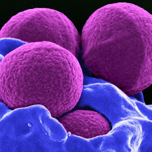 Staphylococcus Removal | Get Rid of the Bacteria & Reduce Pain and Rashes