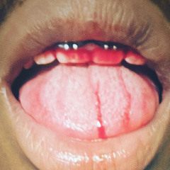 when i od in my room. ✰ x 6MANE ✰