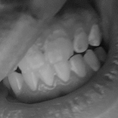 AI CANT GENERATE MY DENTAL HEALTH OR THE WRINKLES ON MY SACK