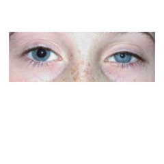 VOLTRA -  COMPOSITE (KLAUDIO ∞ HPX EDIT)