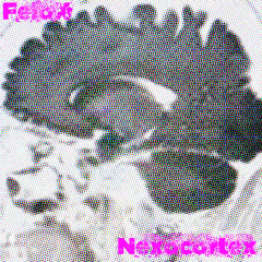 Nexocortex