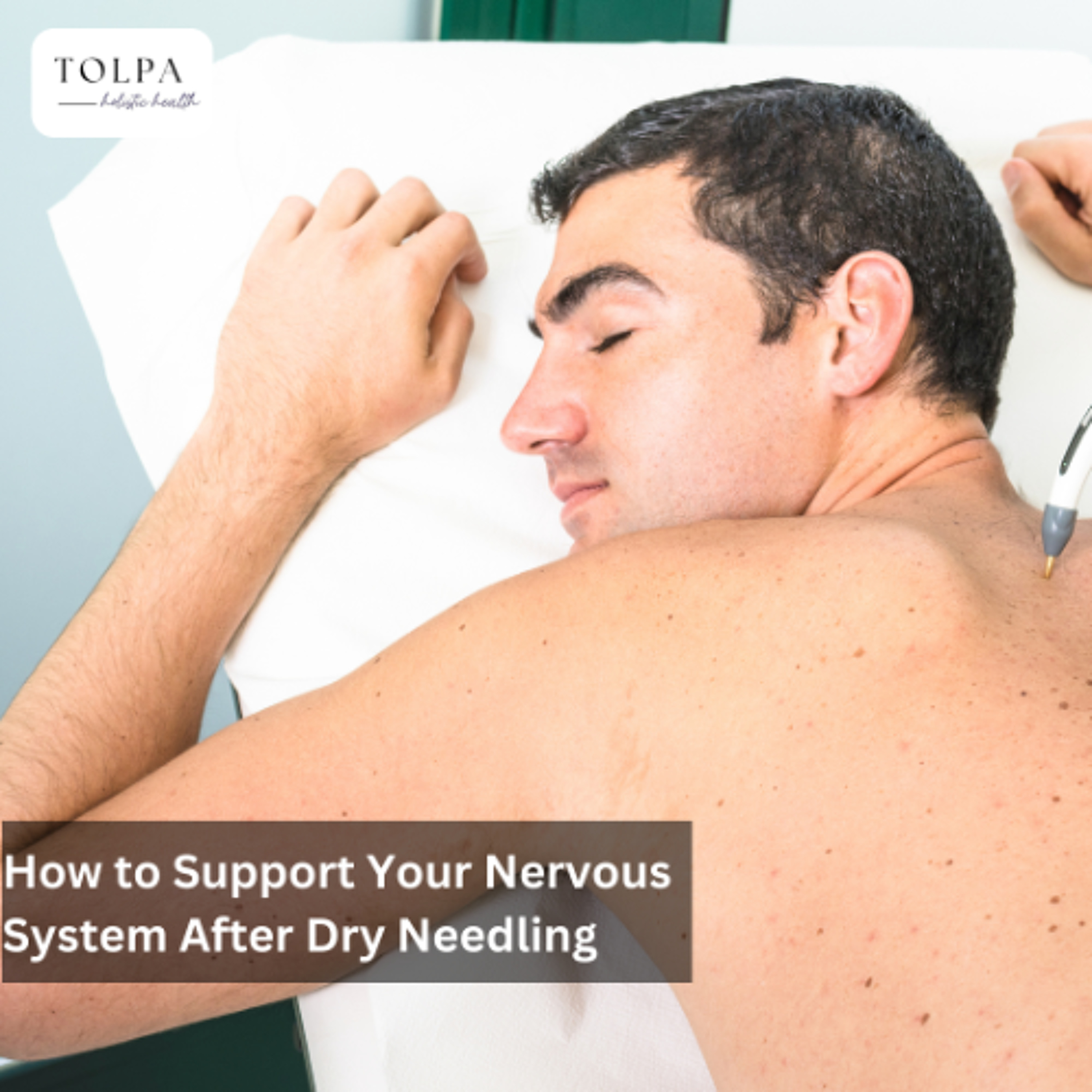 How to Support Your Nervous System After Dry Needling