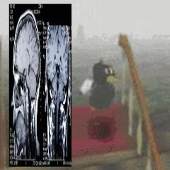 what thea heard after falling down the staircase