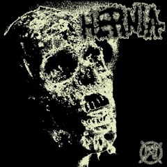 HERNIA EP