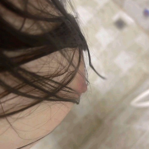 Cmt