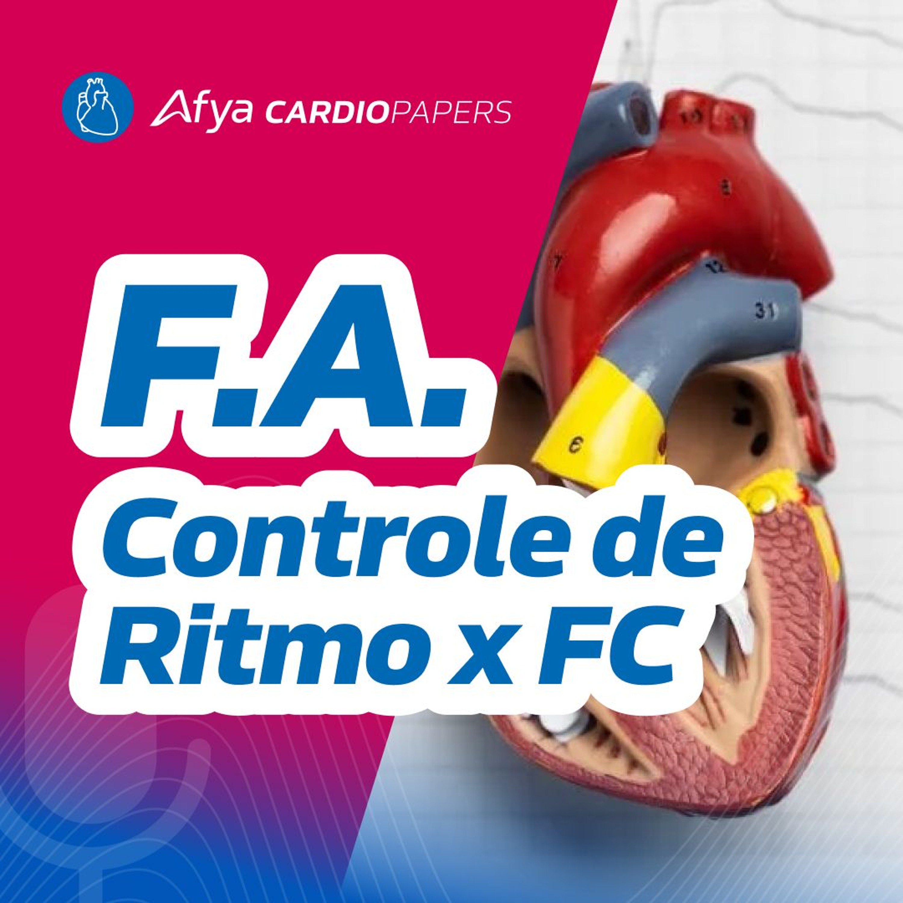 Controle de ritmo ou frequência cardíaca na Fibrilação Atrial? episode artwork
