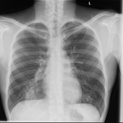 Knee High prod. Skyguy