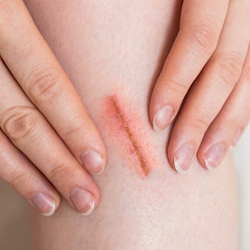 Injury Recovery Boost | Accelerate Wound Healing & Restore Skin without Scars