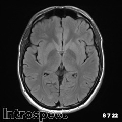 Introspect | [KL004]