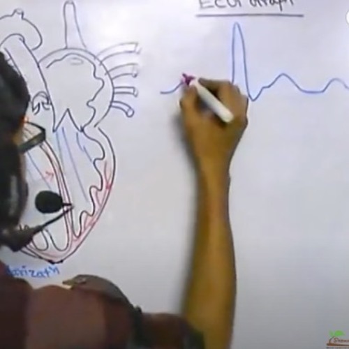 ECG