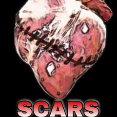 Scars