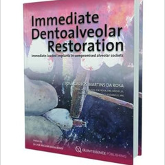 [Access] EBOOK 📨 Immediate Dentoalveolar Restoration: Immediately-loaded Implants in