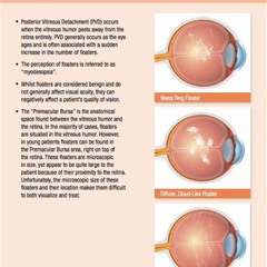 Best Floater In Eye Treatment Reviews