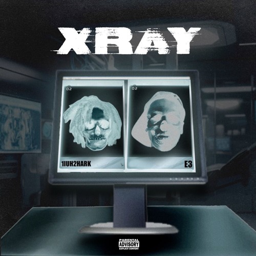 X-Ray (feat. 0nly_e3)
