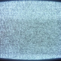 TV TIME (TENNA'S BIG SHOT)