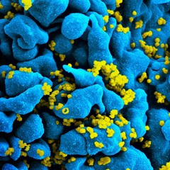 Protocol to HIV Destruction via Stem Cells| Dr. David Greene Arizona