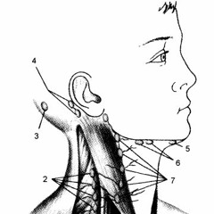 Meek Mill's lymph node