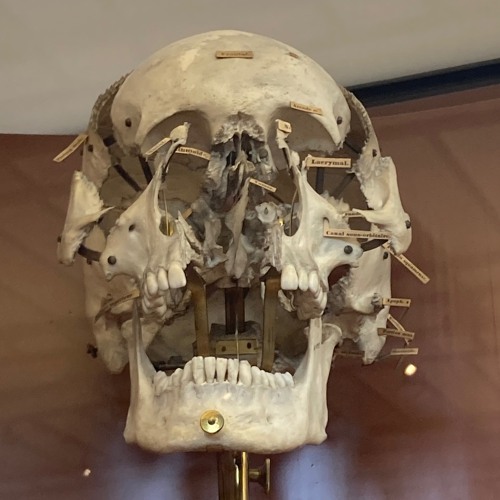 Real2Real - Ozempic face